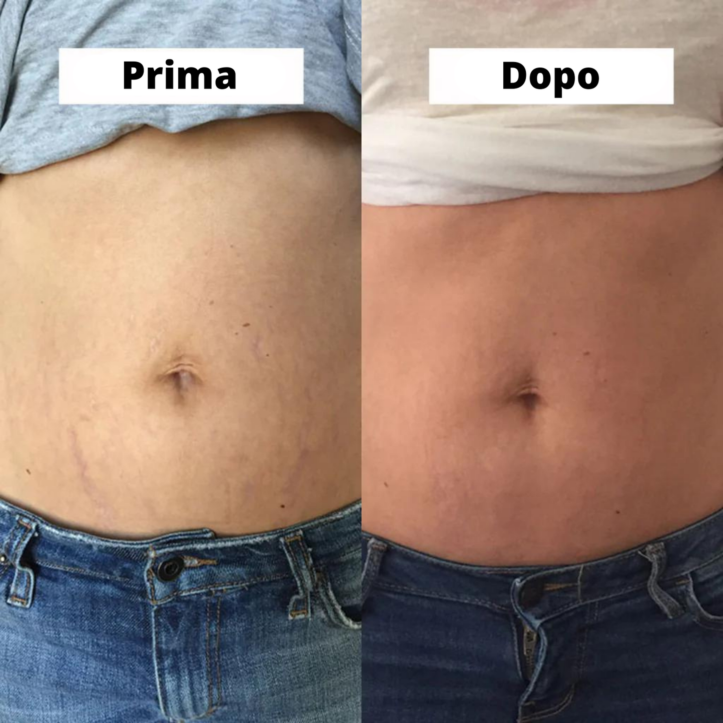 Crema rassodante per la pancia