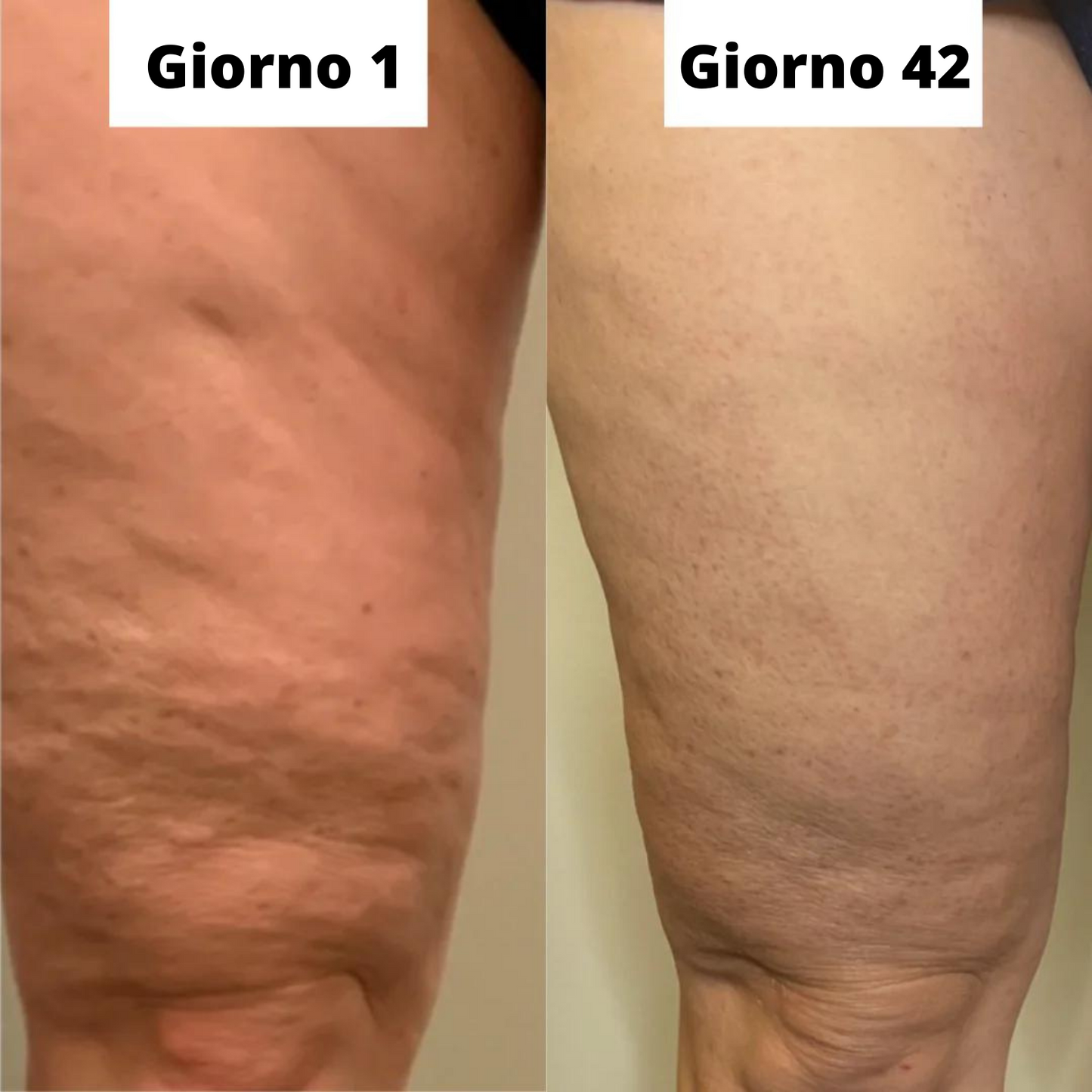 Crema rassodante per le cosce