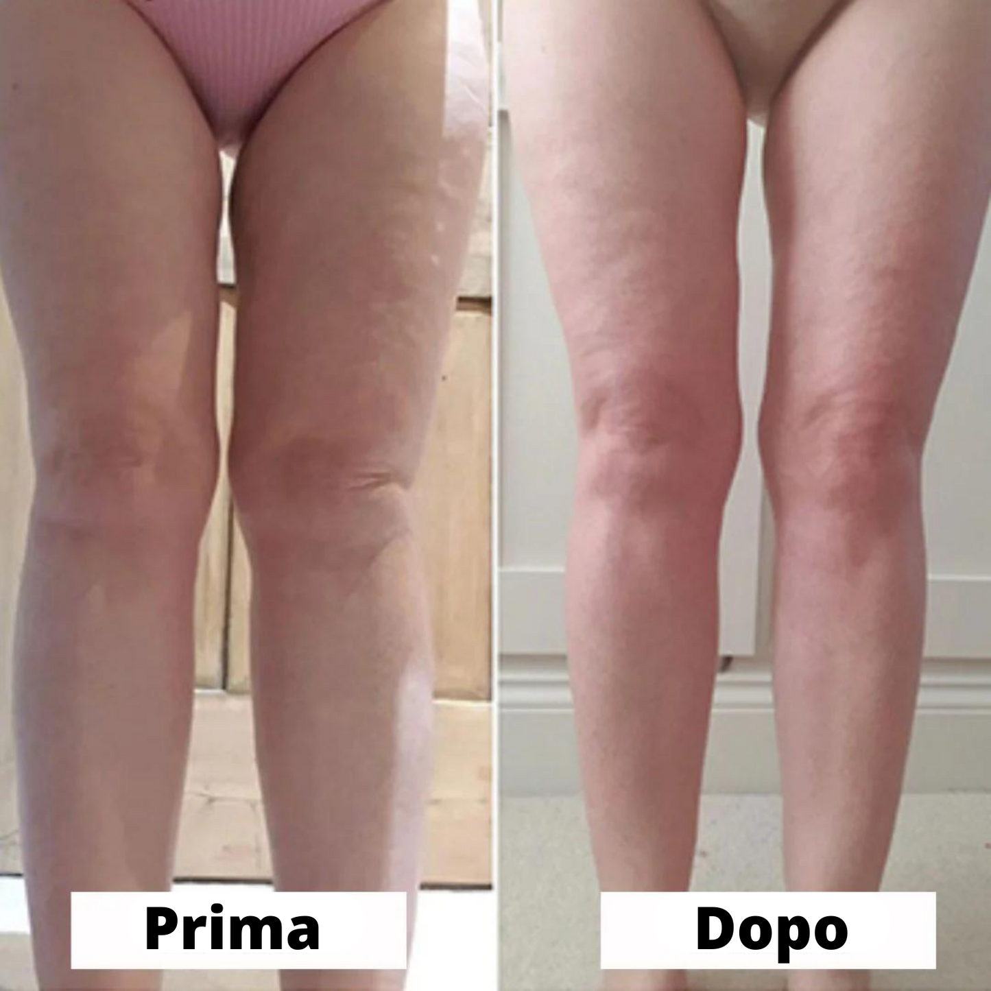 Crema rassodante per le cosce