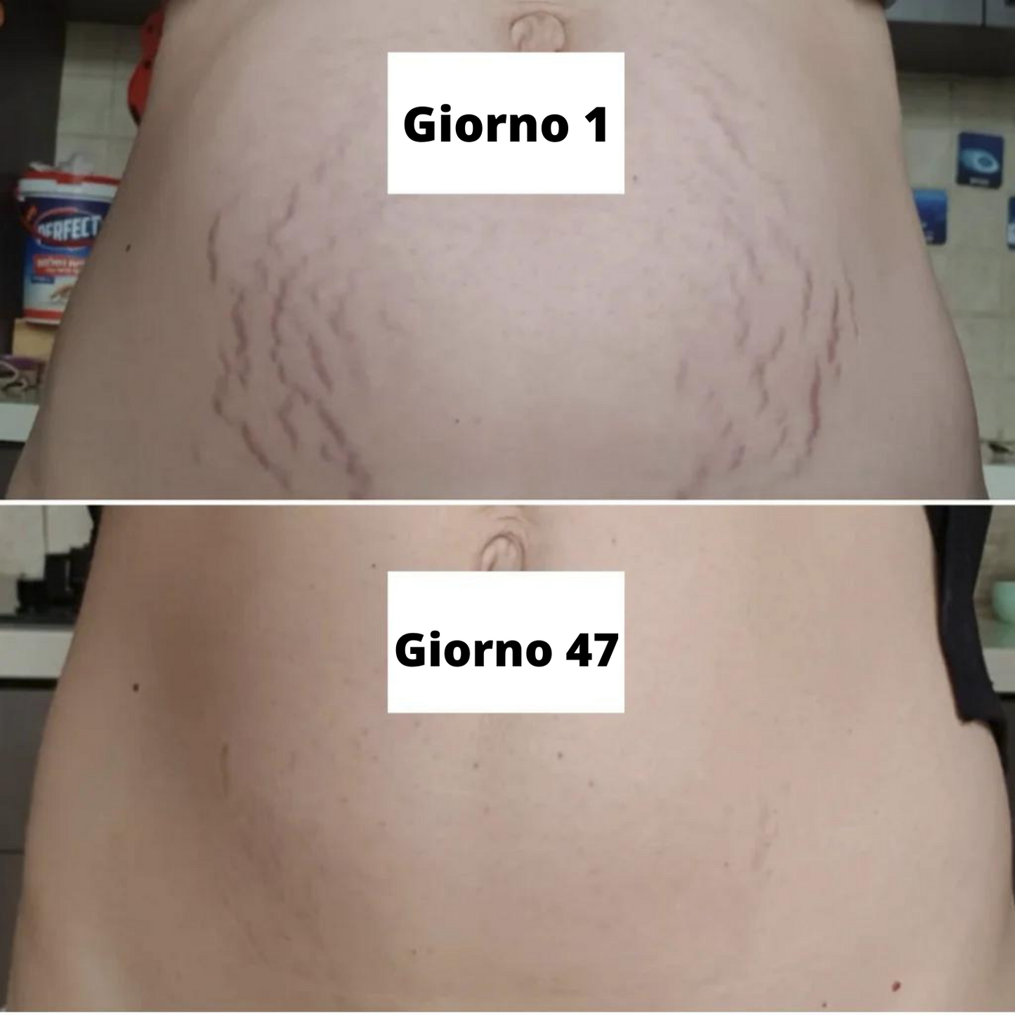 Crema rassodante per la pancia