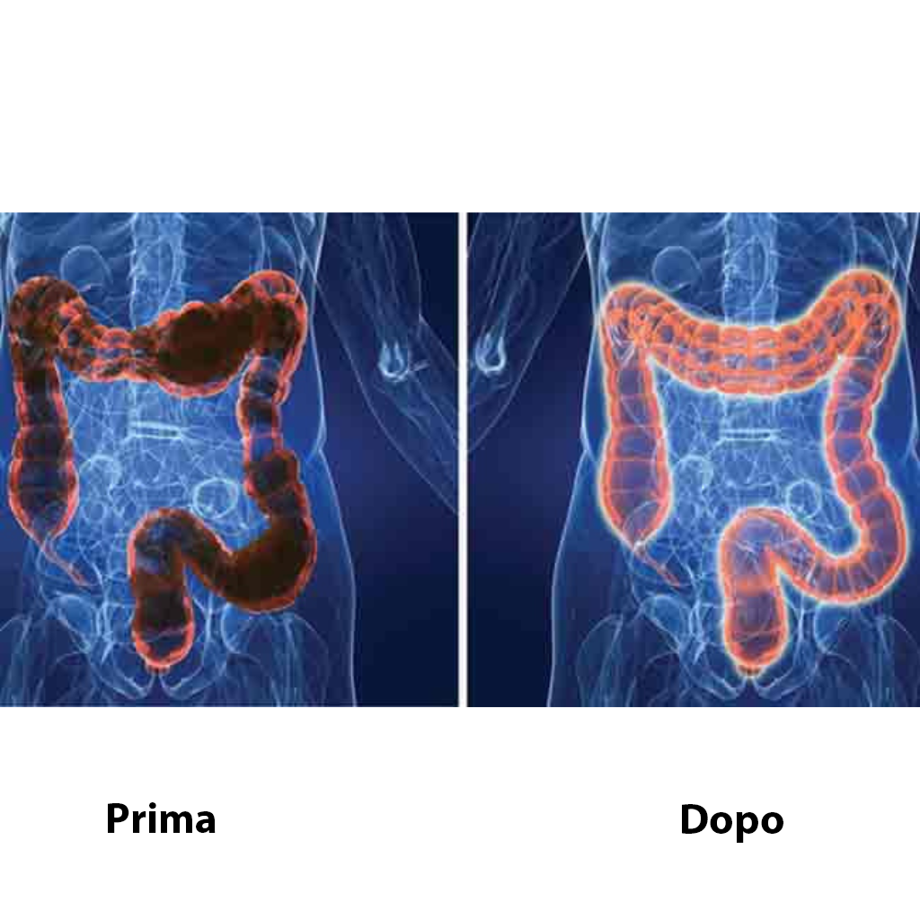 INNO CLEANSE Complesso erboristico per la pulizia del colon